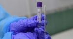 Плюс 16: новые случаи коронавируса выявлены в Абхазии