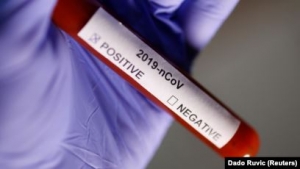 В Абхазии за сутки выявили 19 новых носителей коронавируса